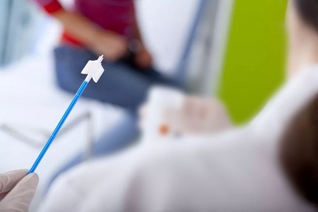 Fejlesztések a méhnyakrák szűrésében: Az öngyűjtés HPV tesztek szerepe