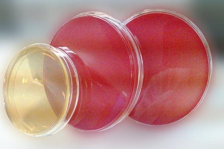 Salmonella Shigella agar (SS): A kórokozó izolálásához szükséges alapvető közeg