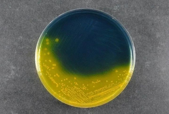 Az élelmiszerbiztonság biztosítása: A BABIO Salmonella Shigella Agar (SS) támogatja a globális kórokozói észlelési szabványokat