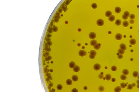 A Babio kiváló minőségű Baird-Parker agar-bázissal indítja el a megbízható Staphylococci tesztelést