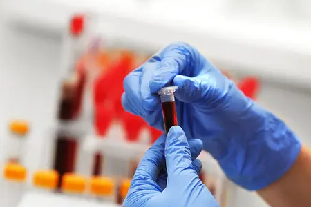 Gyors maláriafelismerés: A BABIO kettős antigén tesztkészlete felerősíti a globális egészséget