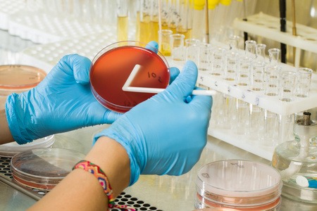 BABIO MacConkey agar táptalaj – Prémium szelektív izoláció a globális mikrobiológiai diagnosztikához